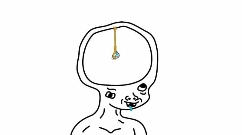 Brain Atrophy